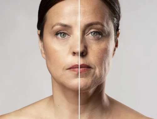 Tixel® Skin Resurfacing